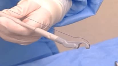 Digitex® Suture Delivery System - Manish Patel, MD