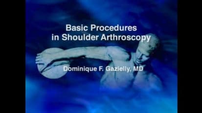 Basic Procedures in Shoulder Arthroscopy
