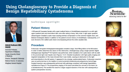 Using Cholangioscopy to Provide a Diagnosis of Benign Hepatobiliary Cystadenoma Presented by Abhijit Kulkarni M.D. FASGE