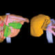 The left image shows a patient’s liver with cancer metastasis from the colon in red, with areas to be removed in the first stage of ALPPS in green. The blue line shows where the liver will be divided. The right image shows the liver after the first stage of ALPPS. The prior liver metastasis has been removed and the liver has been divided. The left liver has grown sufficiently to allow removal of the diseased right side.