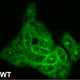 Normal hamster ovary cells with green staining to show the distribution of cholesterol