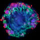 Human kidney organoid showing podocytes (red) and proximal tubules (green) developed in the Freedman lab