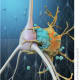 A microglial cell (yellow) attached to an ischemic neuron (gray) that has been tagged by complement proteins (blue).