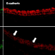 Chronic airborne particulate matter (PM) exposure in mice  causes a breakdown (white arrows) in sinonasal epithelial junctional proteins, claudin-1 (green left column) and e-cadherin (middle red column) when compared to mice exposed to filtered air (FA) as measured by immunofluorescence and confocal microscopy. This breakdown may allow for increased susceptibility to other allergens, viruses or bacteria.