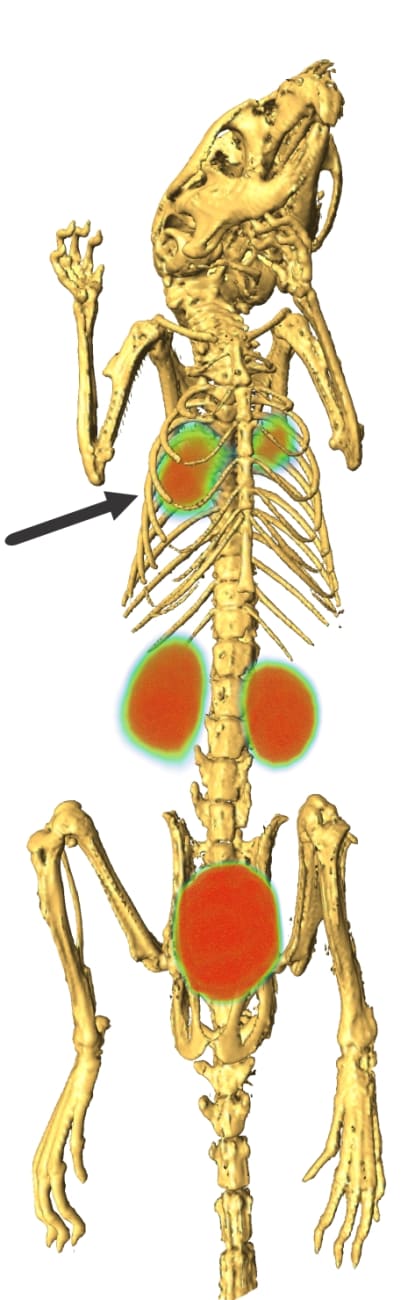 Bmed_Pneumonia