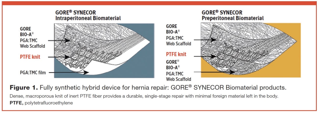 GORE® SYNECOR Biomaterial image 1