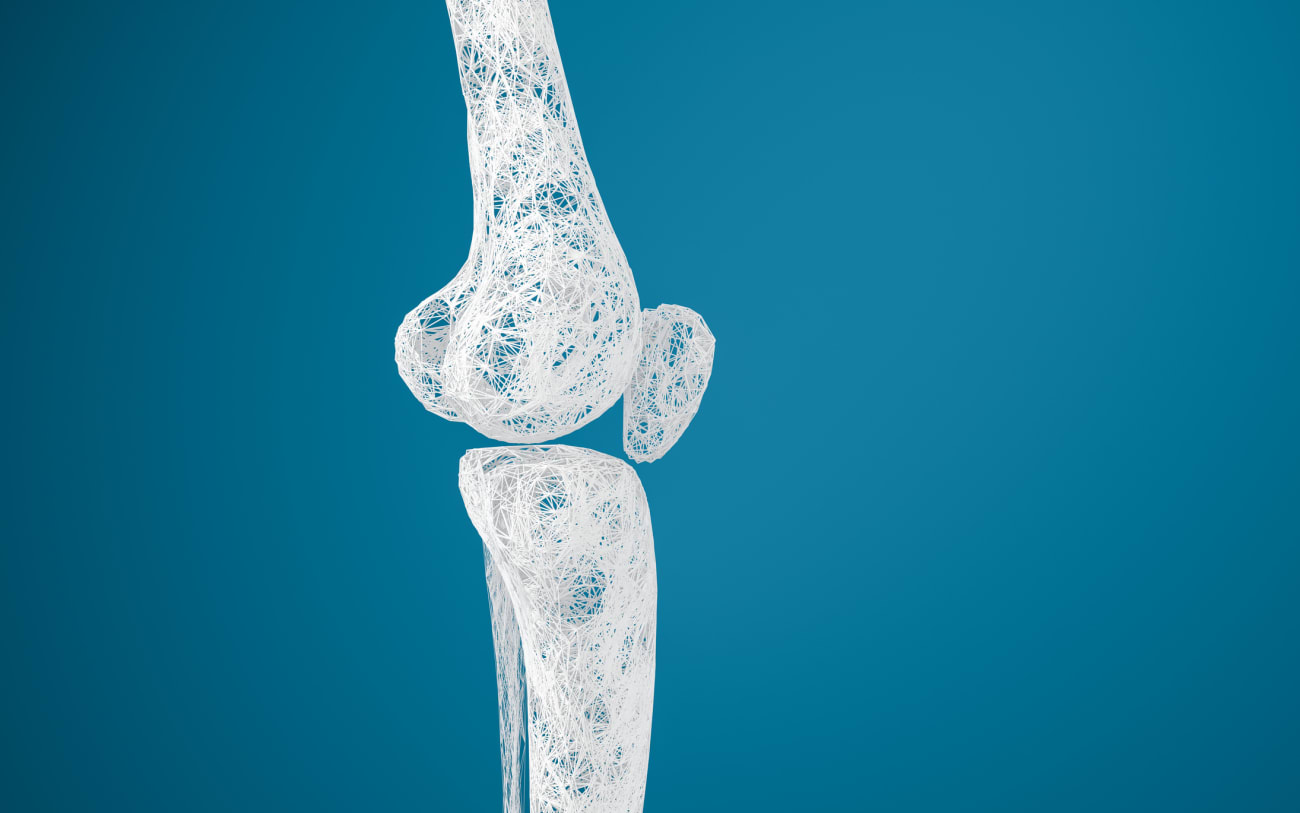 UCSF/IGOT Pediatric Limb Differences Webinar 2026 — Osteomyelitis in Children and Young Adults: A Global Perspective