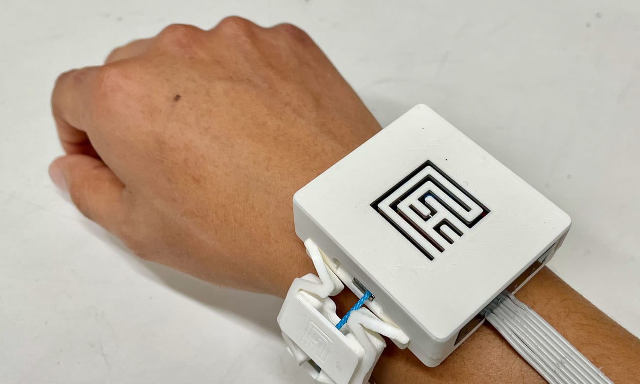 Photo shows a white plastic square device around a person’s wrist, with wires running up the arm