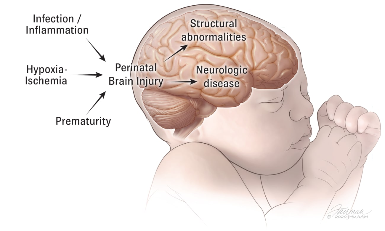 COVID-19 in pregnancy: implications for fetal brain development