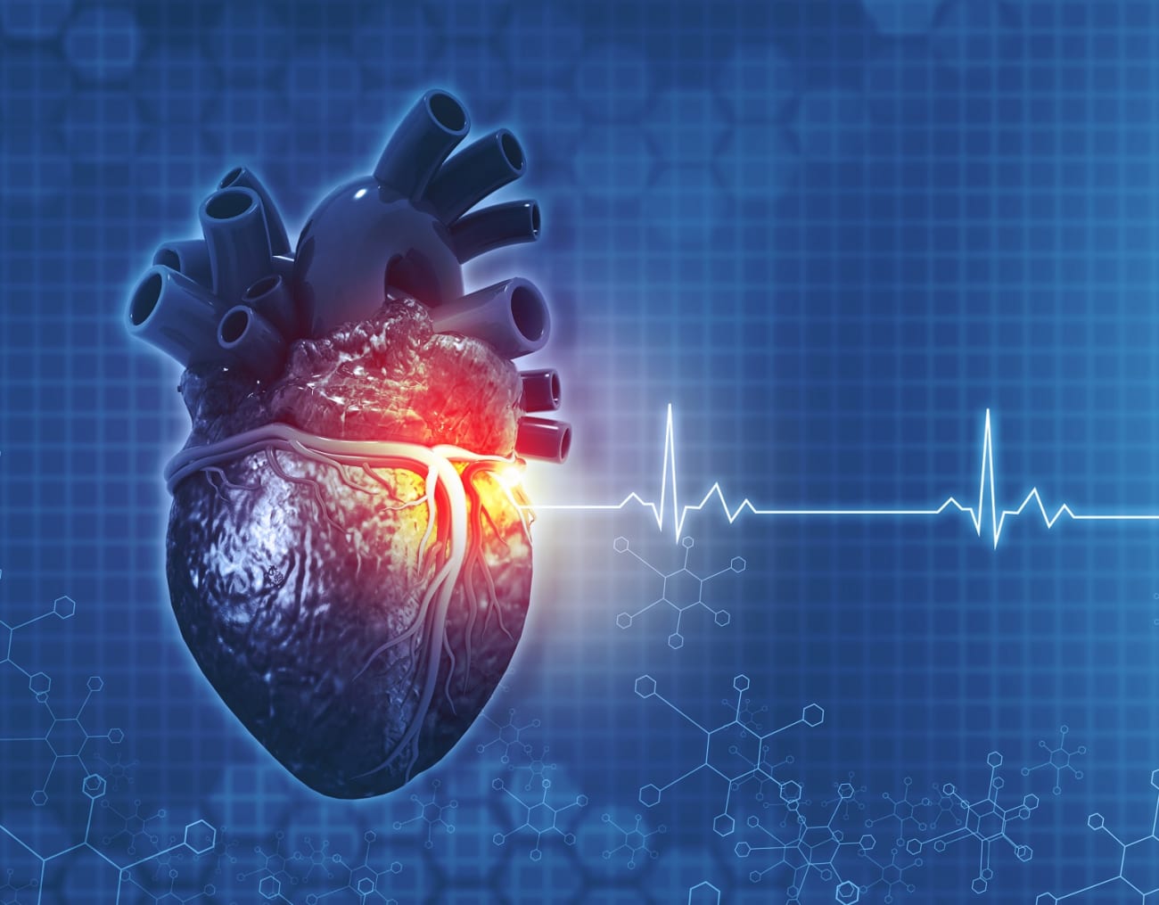Cardiac Surgery Reinvented: Landmark Minimally Invasive Technique Cardiac Surgery Reinvented: Landmark Minimally Invasive Technique