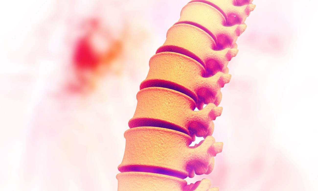 Combining Two New Surgery Techniques to Improve Spine Johns