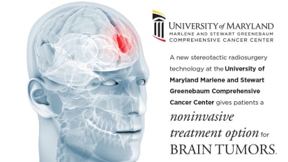 Next Generation Treatments for Brain Tumors: The Already Realized and the Promising