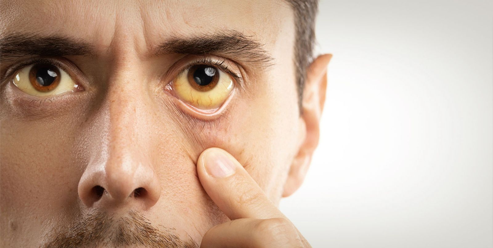 ANEMIA FALCIFORME: ENTENDA AS CAUSAS E TRATAMENTOS