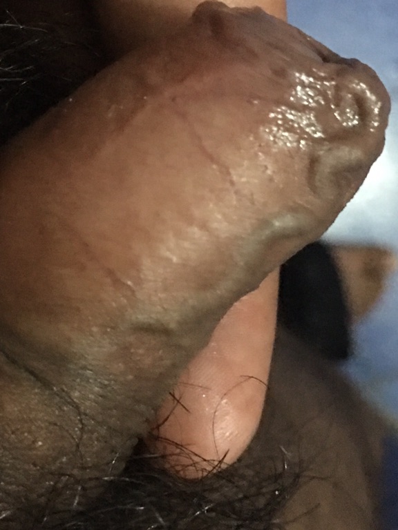 penis vaeins sexual gross stories disgusting