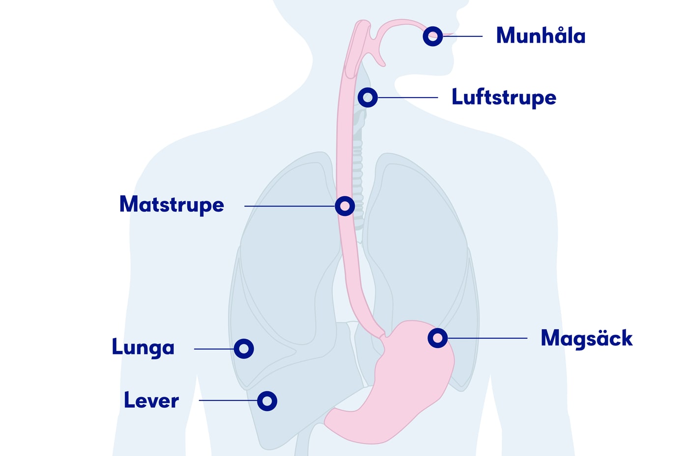 Illustration matstupen, matstrupscancer