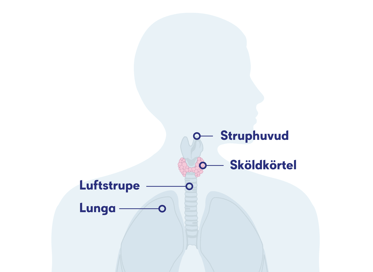 Illustration sköldkörteln, sköldkörtelcancer