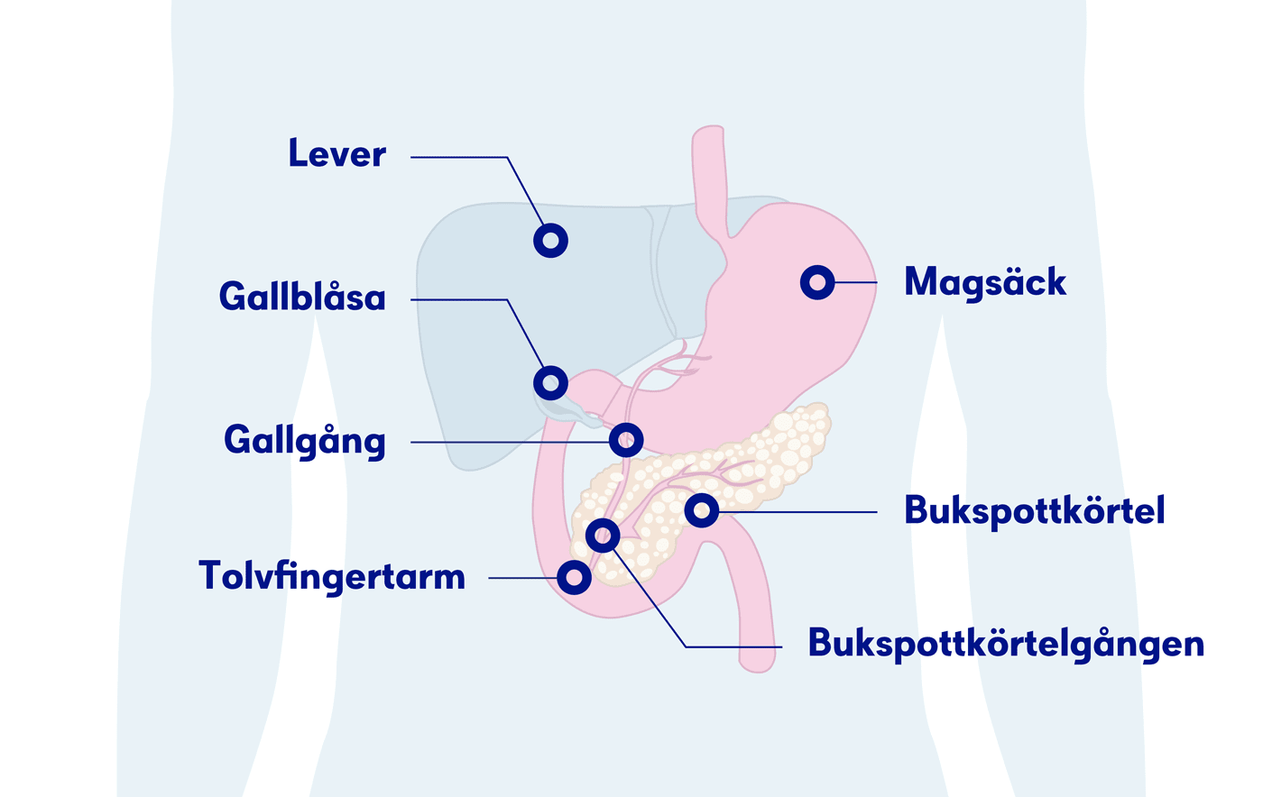 Illustration bukspottkörteln, bukspottkörtelcancer