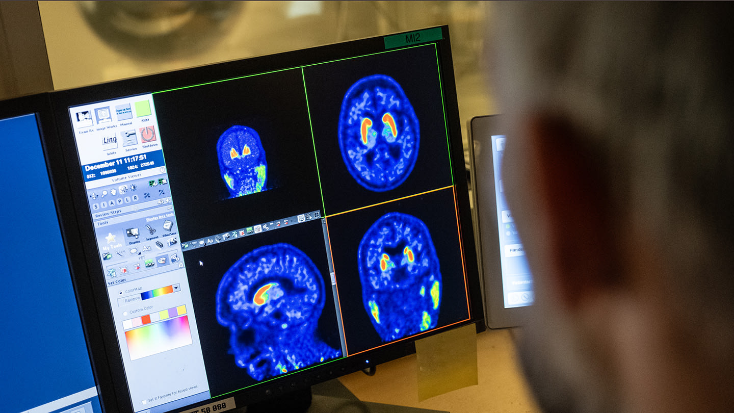 Bild på en skärm från datortomografi
