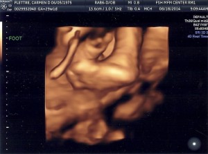 3D scan capturing baby's foot (the baby would not cooperate and give a profile and since this was a medical sonogram and not a paid one they don't wait around for the baby to pose).
