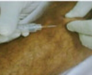 Ortomolecular : Terapia com Ozônio
