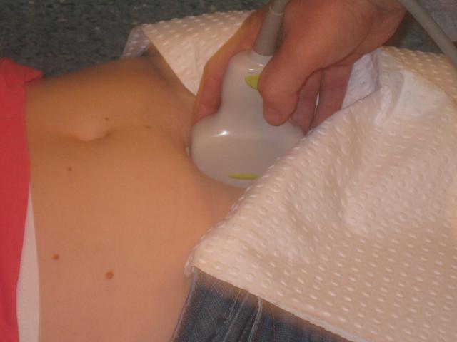 Sagittal View - transducer angled caudally along midline