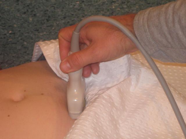 Transverse View - Probe angled caudally and aligned along the transverse axis