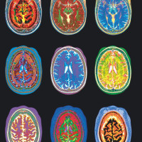 Colorful brain scans
