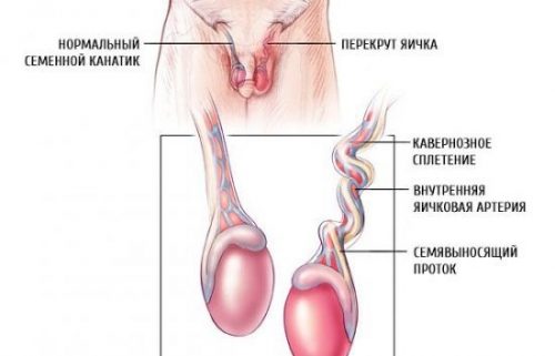 Тестикулы