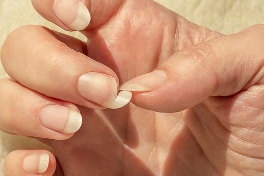Quick Fix for a Broken Nail at Home

Description of Issue