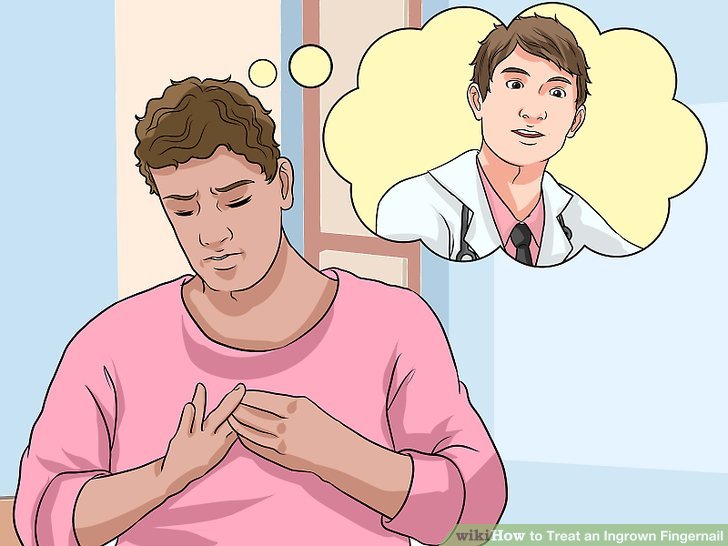 Image titled Treat an Ingrown Fingernail Step 13