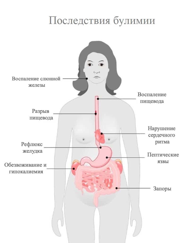 Последствия булимии