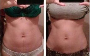 внутренние мышцы живота