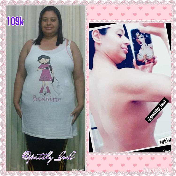 neiadias27: Essa ? minha amiga @patthy_leal ela ja perdeu mais de 45 kg quer saber como??? Siga o ig dela la vc