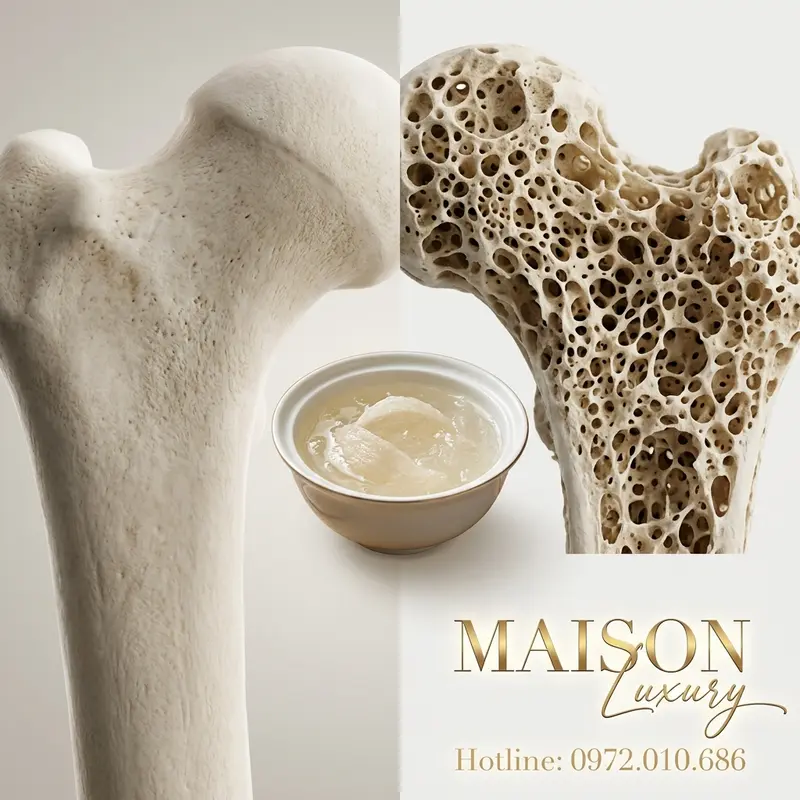 Hình ảnh minh họa sự đối lập giữa xương chắc khỏe và xương bị loãng, với yến sào như một yếu tố dinh dưỡng trung tâm.