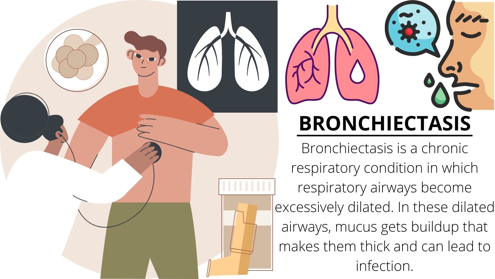 Best Homeopathic treatment for bronchiectasis treatment in delhi