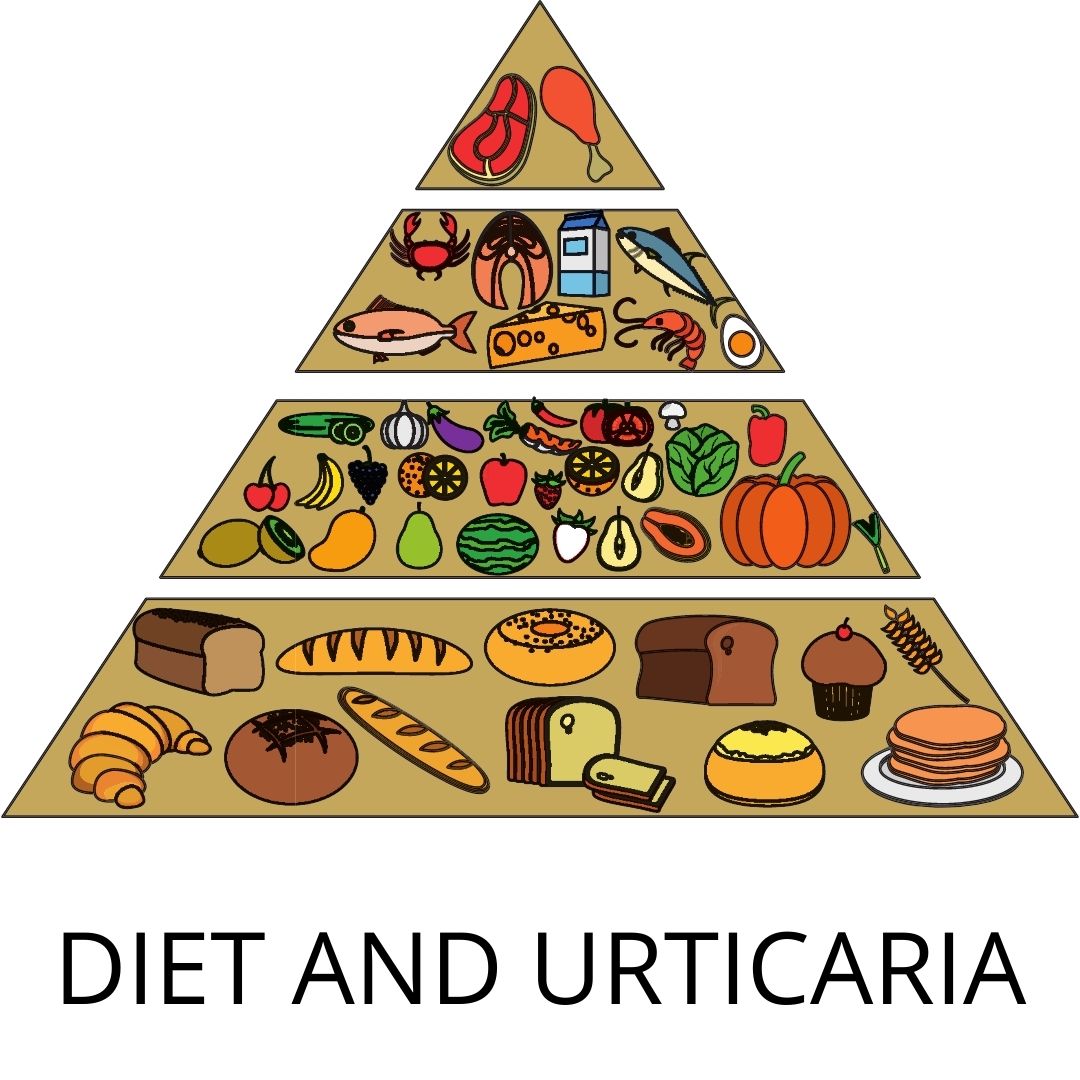 DIET FOR MANAGEMENT OF URTICARIA