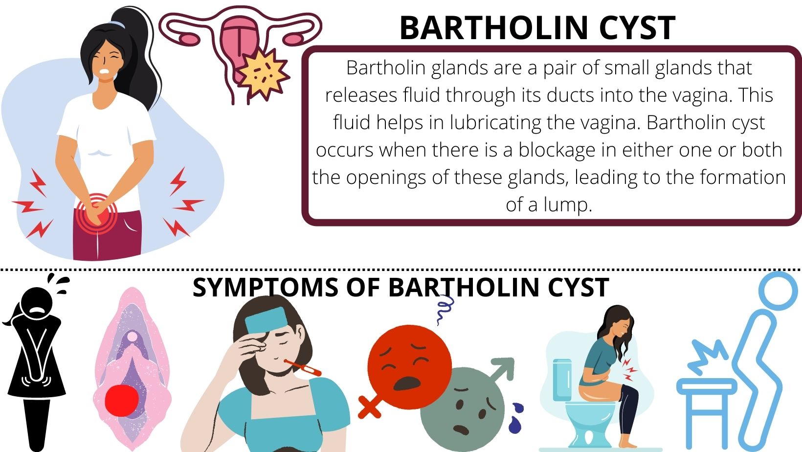 THIS IS WHAT I WAS SICK WITH. Bartholin Cyst 