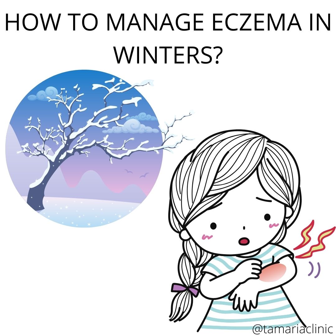 HOW TO MANAGE ECZEMA IN WINTERS?