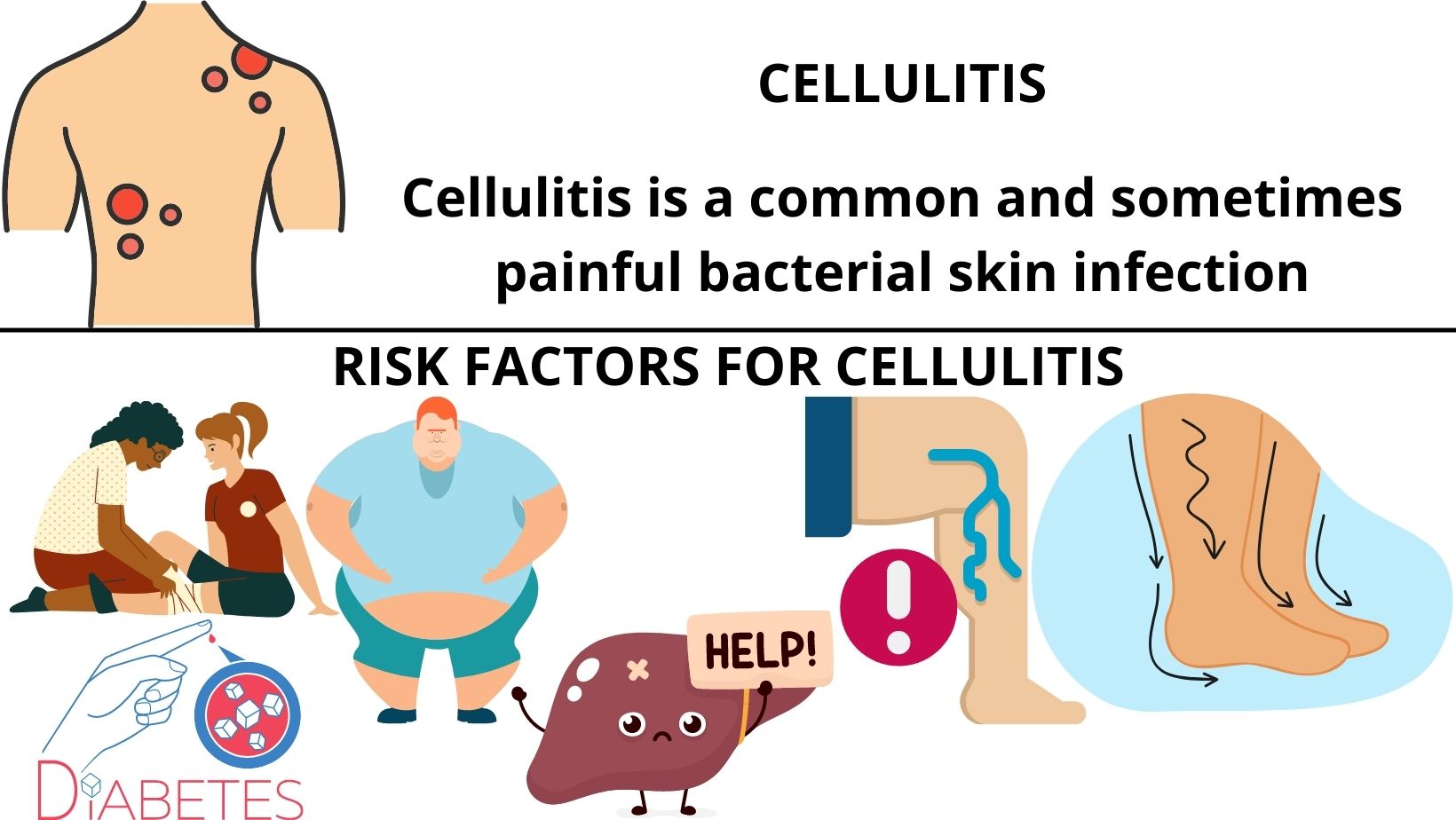 Cellulitis Causes Signs Symptoms Diagnosis Prevention 