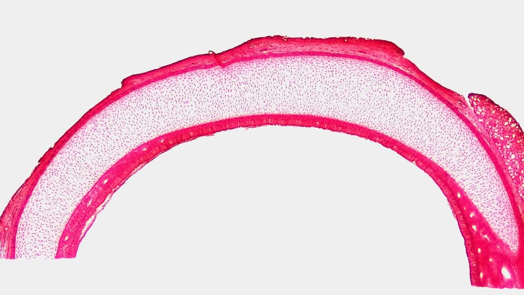 Cover Image for Hy2Care: Pioneering Cartilage Repair with €4.5M Funding Boost