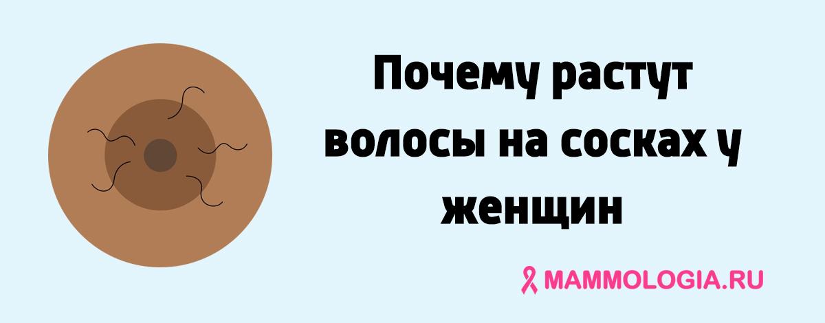 Волосы на груди и сосках у женщин: причины появления и способы избавления