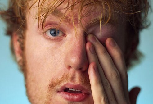 A young man rubs his irritated eye.