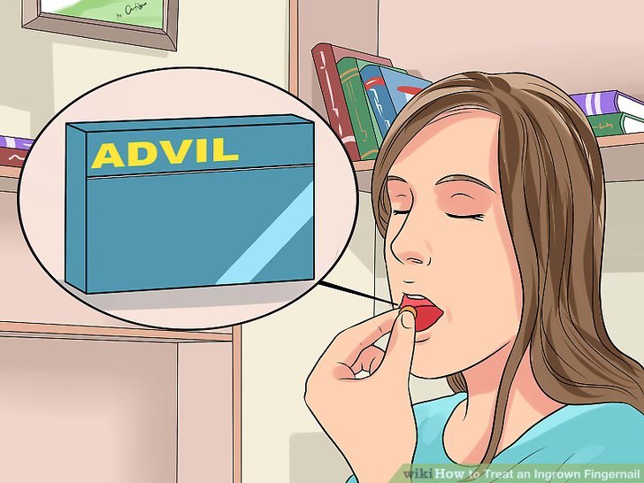 Image titled Treat an Ingrown Fingernail Step 4