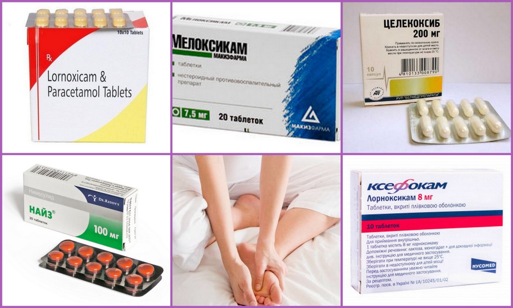 Таблетки от артрита суставов. Таблетки от артрита суставов: список лекарств для лечения заболевания. Ревматоидный артрит лечение мази таблетки 🚫 Народные средства от болей. Ревматоидный Артрит Снижение Веса — Похудение Диета Правильное Питание