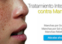 Tratamiento para Manchas en la cara