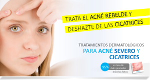 dermatologo acne, dermatologos acne, tratamiento acne, tratamiento para acne, tratamiento del acne, tratamiento para el acne