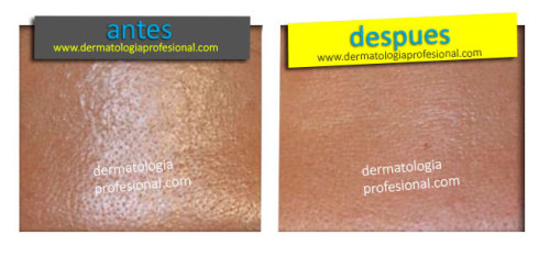Fotos Antes y Despues