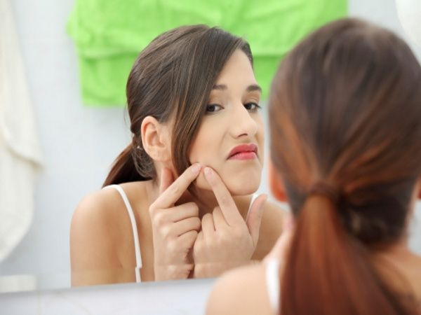 acne boda, eliminar el acne para mi boda, como eliminar granos de la cara, combatir el acne