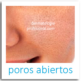 acne, que hace un dermatologo, tratamientos para acne, cicatrices, imagenes del acne, eliminar las cicatrices, quitar manchas de la piel, marcas en la cara, barroy espinillas, poros abiertos, enrojecimiento, barros enterrados, puntos negros