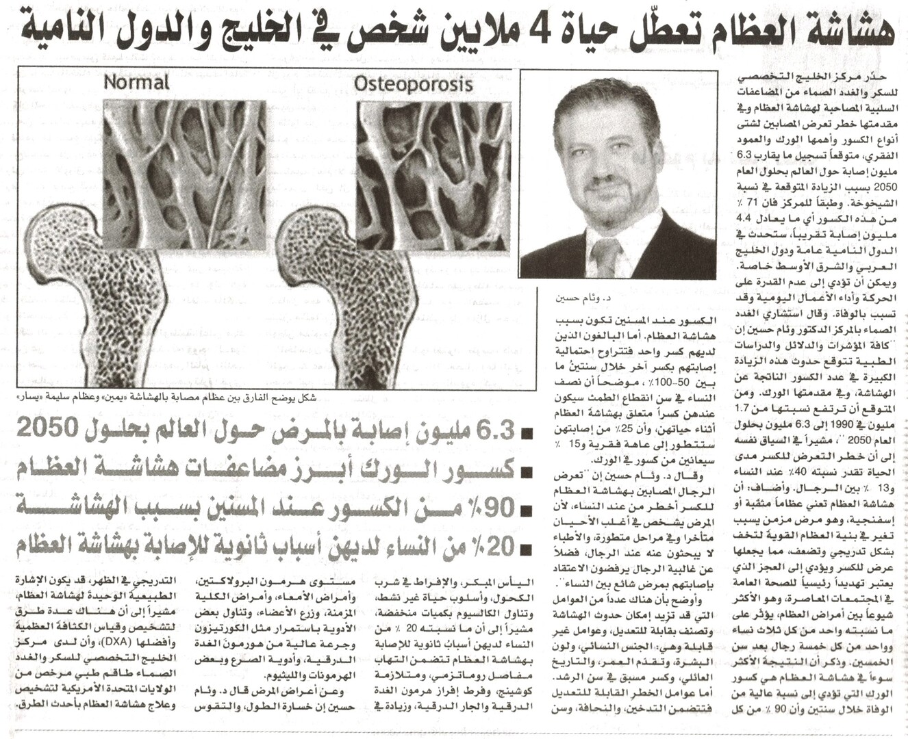 Osteoporosis Disables the Lives of 4 Million People in the Gulf and Developing Countries